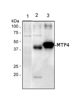 western blot detection using anti-MTP4 antibodies